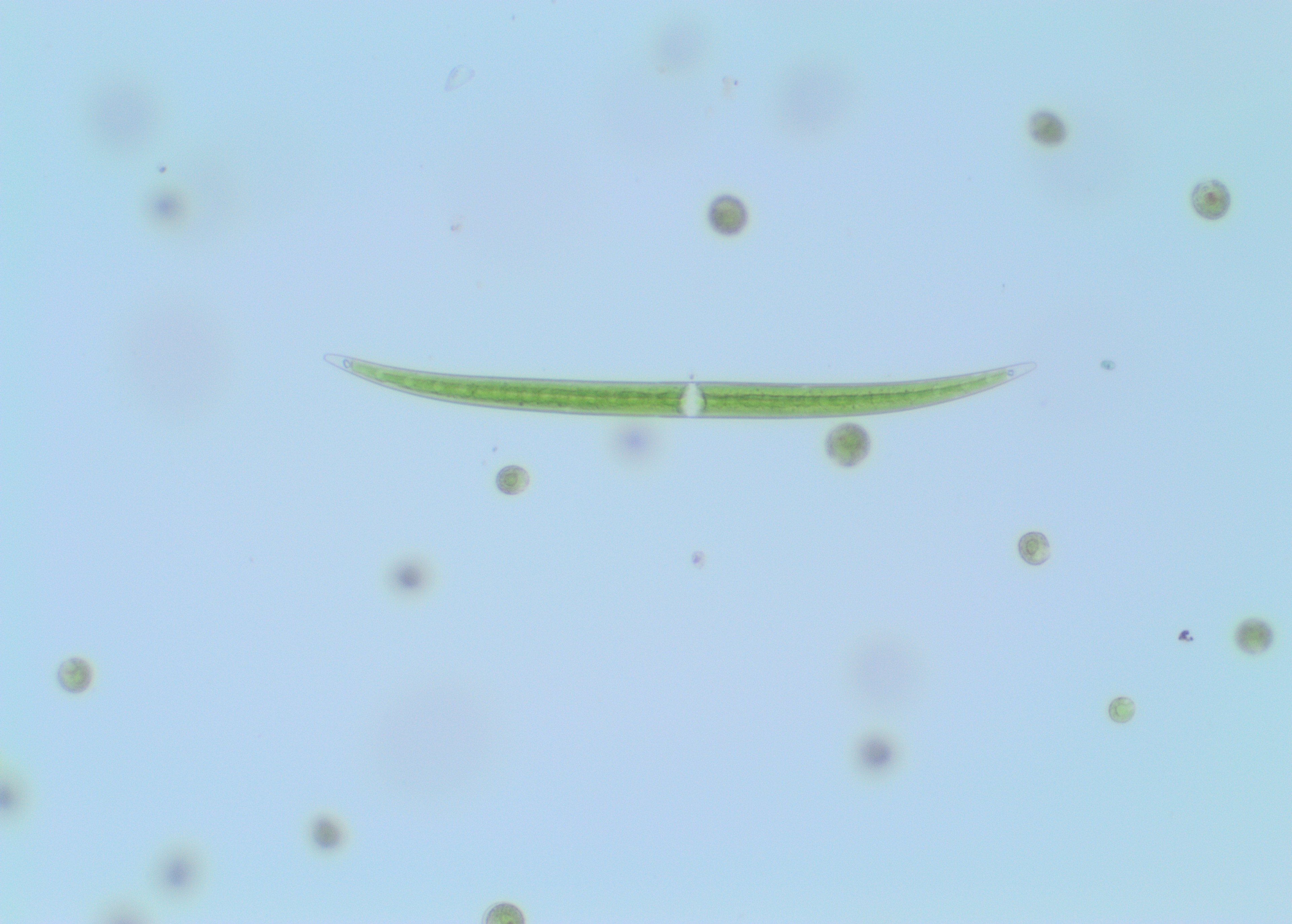 Closterium plankton